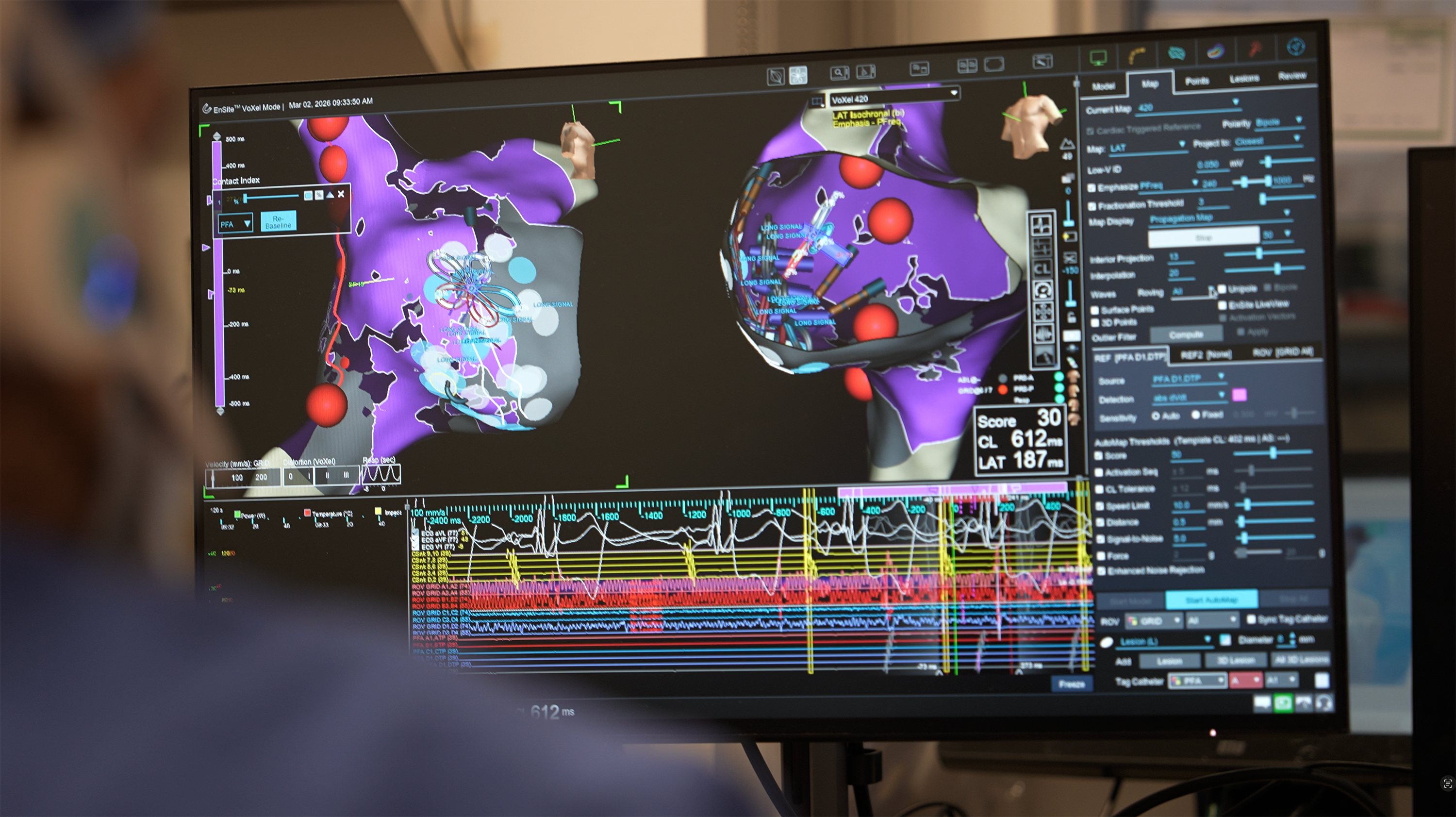 Cath Lab monitor