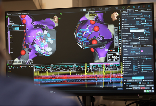 cath lab computer screen